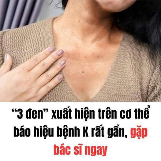 “3 đen” xuất hiện trên cơ thể báo hiệu bệnh K rất gần, gặp bác sĩ ngay